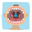 TONSIL